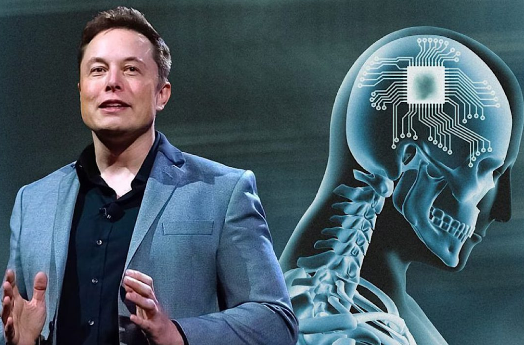 Elon Musk Confirm Que Su Empresa Neuralink Implant El Primer Chip